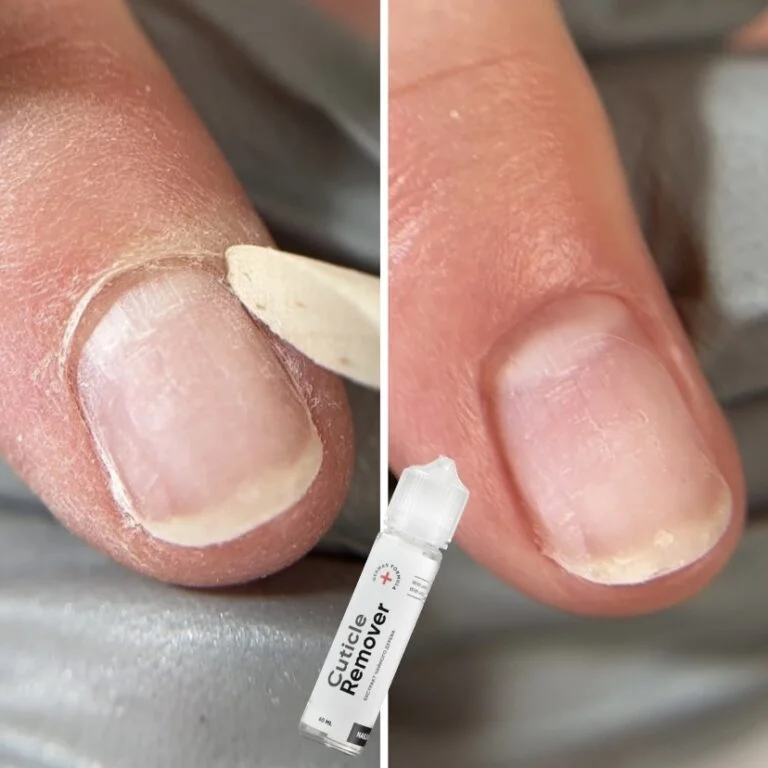 img_5228-768x768 NAILSOFTHEDAY Cuticle Remover – regeneruojantis odelių valiklis manikiūrui ir pedikiūrui, 10 % šlapalo, 60 ml
