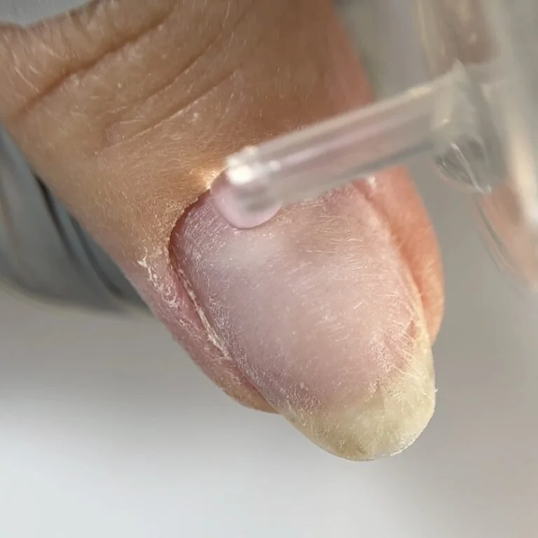 img_5230-768x768 NAILSOFTHEDAY Cuticle Remover – regeneruojantis odelių valiklis manikiūrui ir pedikiūrui, 10 % šlapalo, 60 ml